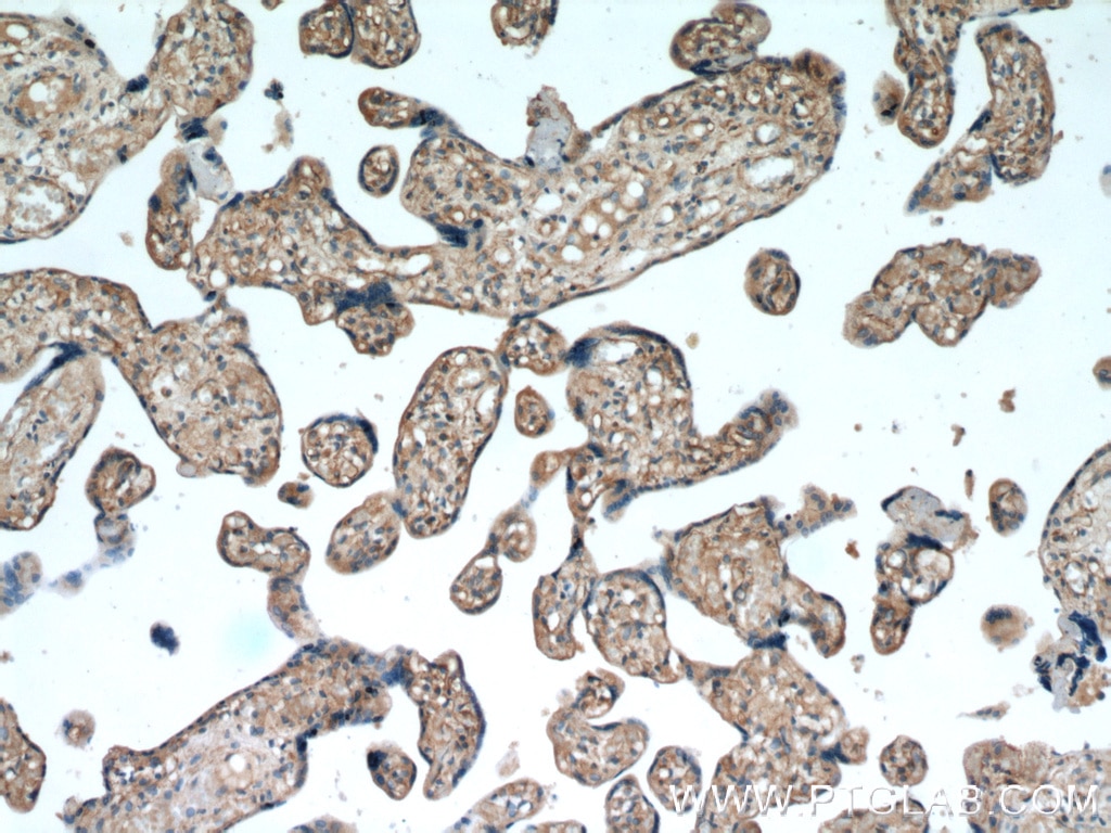 Immunohistochemistry (IHC) staining of human placenta tissue using TRAPPC3 Polyclonal antibody (15555-1-AP)