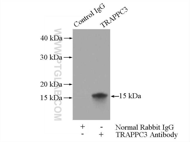 Immunoprecipitation (IP) experiment of mouse liver tissue using TRAPPC3 Polyclonal antibody (15555-1-AP)