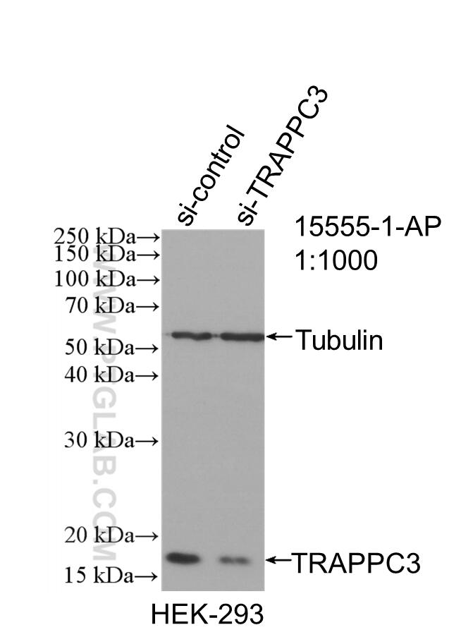 Western Blot (WB) analysis of HEK-293 cells using TRAPPC3 Polyclonal antibody (15555-1-AP)