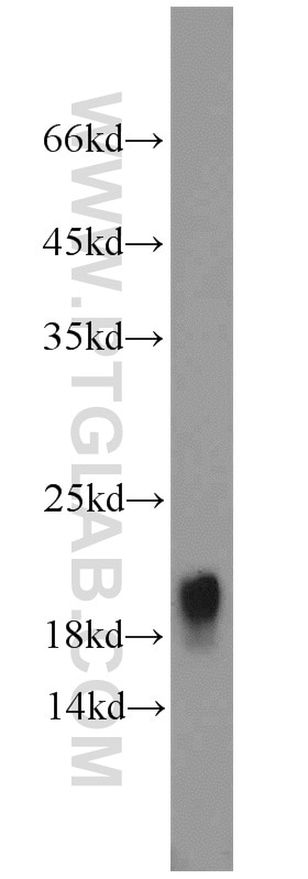 Western Blot (WB) analysis of mouse small intestine tissue using TRAPPC3 Polyclonal antibody (15555-1-AP)