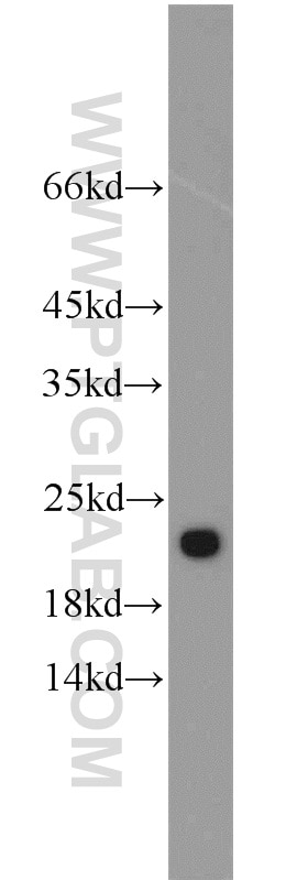 Western Blot (WB) analysis of PC-3 cells using TRAPPC3 Polyclonal antibody (15555-1-AP)