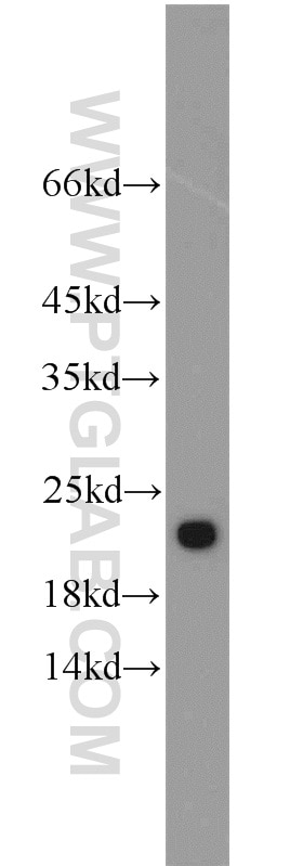 WB analysis of PC-3 using 15555-1-AP