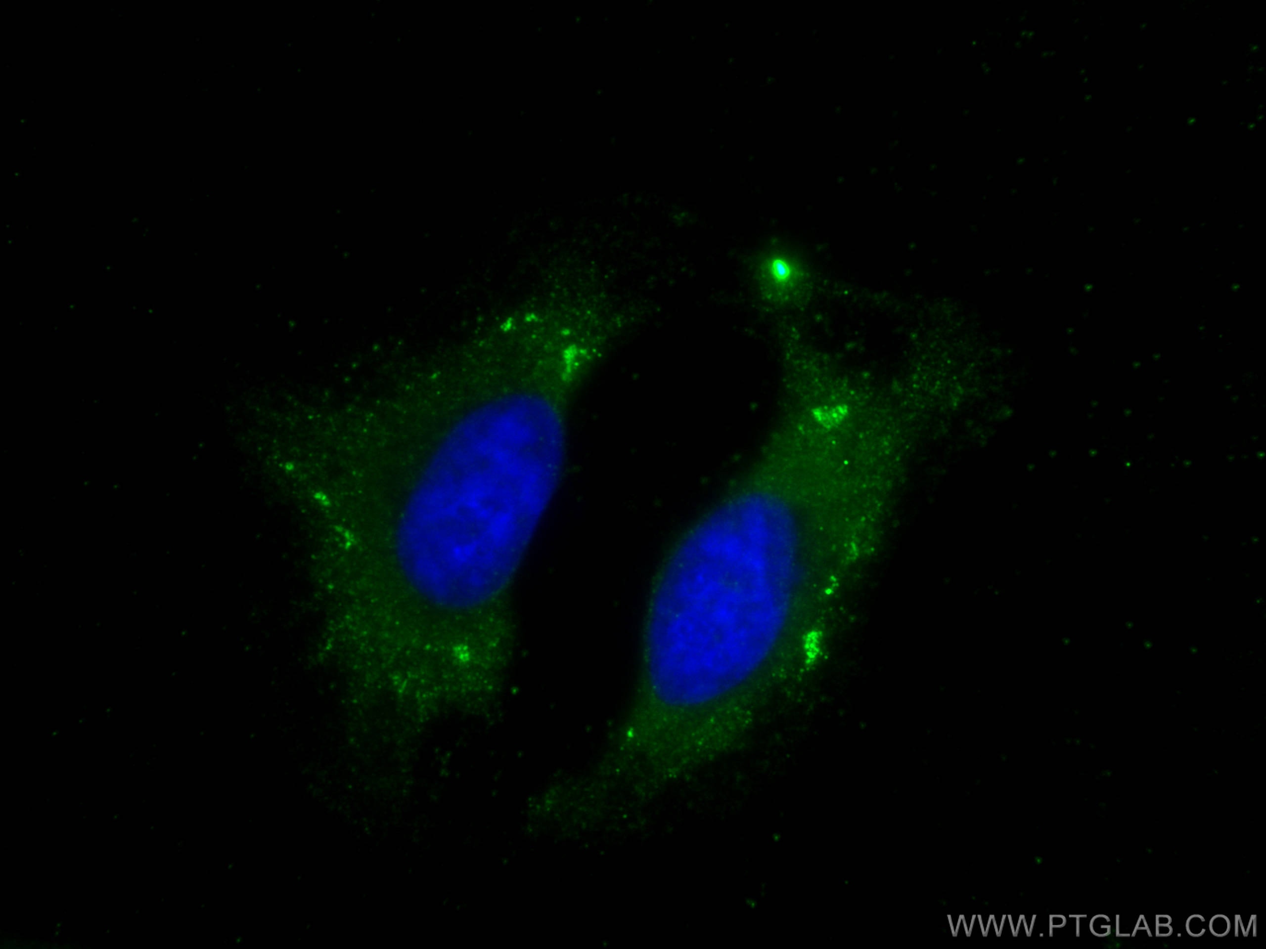 Immunofluorescence (IF) / fluorescent staining of HeLa cells using TRAPPC4 Polyclonal antibody (12074-1-AP)