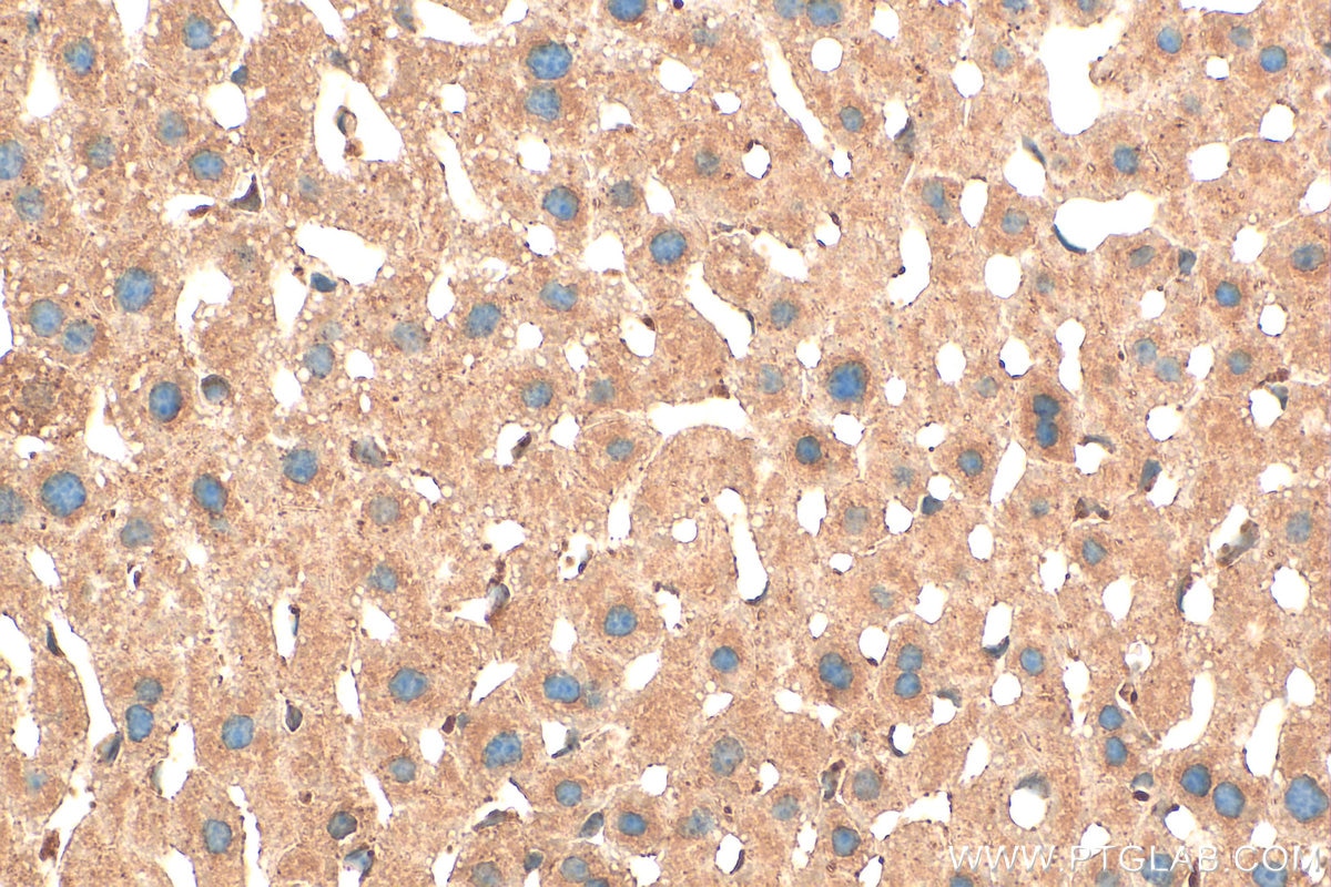 Immunohistochemical analysis of paraffin-embedded mouse liver tissue slide using 12074-1-AP (TRAPPC4 antibody) at dilution of 1:100 (under 40x lens). Heat mediated antigen retrieval with Tris-EDTA buffer (pH 9.0). Immunohistochemistry (IHC) staining of mouse liver tissue using TRAPPC4 Polyclonal antibody (12074-1-AP)