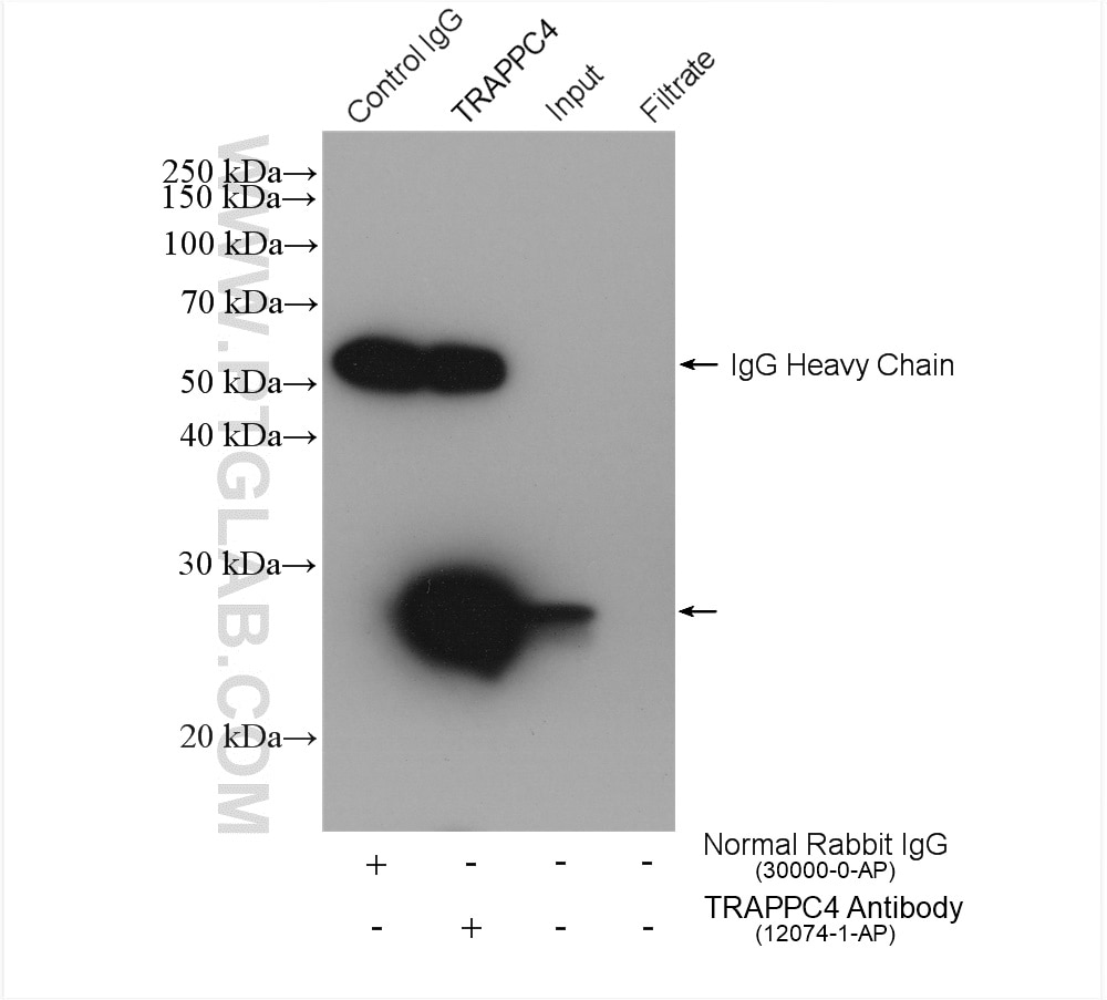 Immunoprecipitation (IP) experiment of HL-60 cells using TRAPPC4 Polyclonal antibody (12074-1-AP)