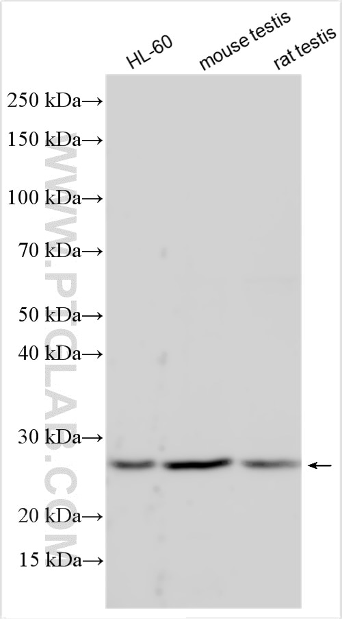 Western Blot (WB) analysis of various lysates using TRAPPC4 Polyclonal antibody (12074-1-AP)