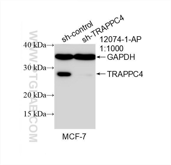 Western Blot (WB) analysis of MCF-7 cells using TRAPPC4 Polyclonal antibody (12074-1-AP)