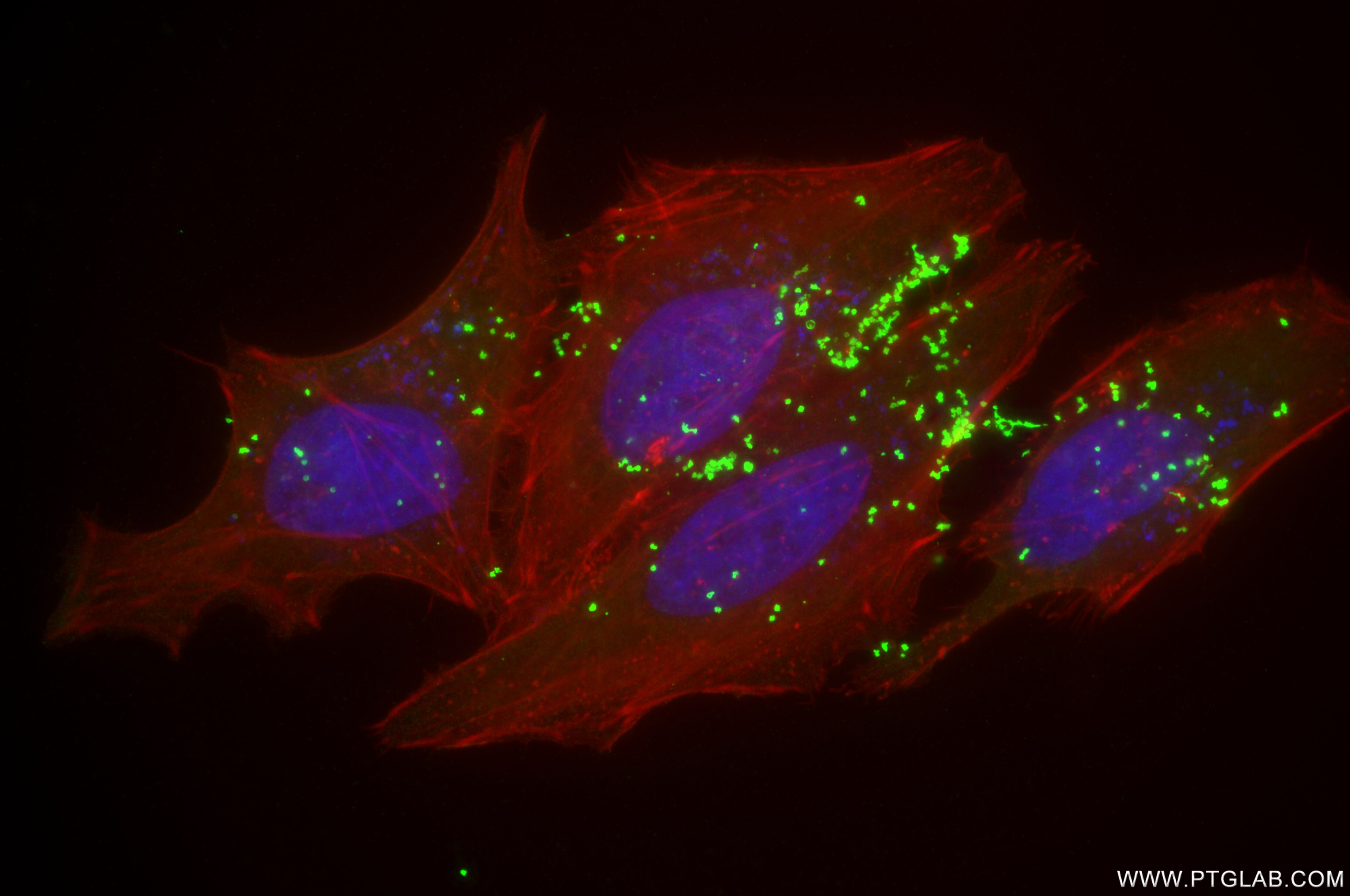 Immunofluorescence (IF) / fluorescent staining of HeLa cells using TRAPPC4 Recombinant antibody (84119-3-RR)