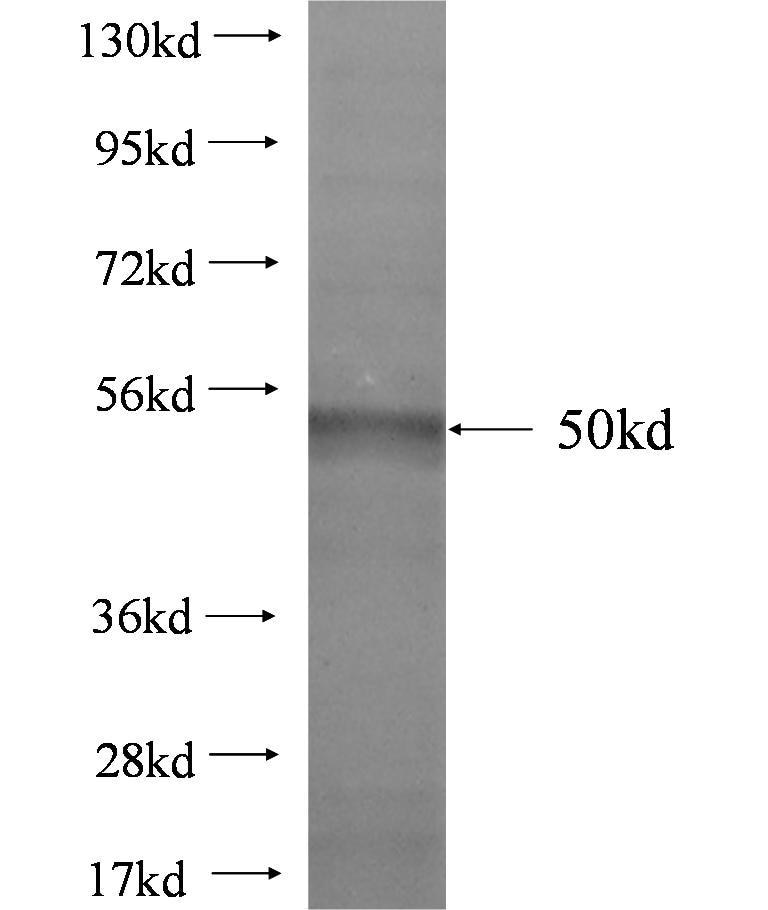 TRAPPC4 fusion protein Ag2737 SDS-PAGE