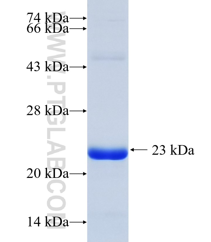 TRAPPC6A fusion protein Ag7492 SDS-PAGE TRAPPC6A fusion protein Ag7492 SDS-PAGE