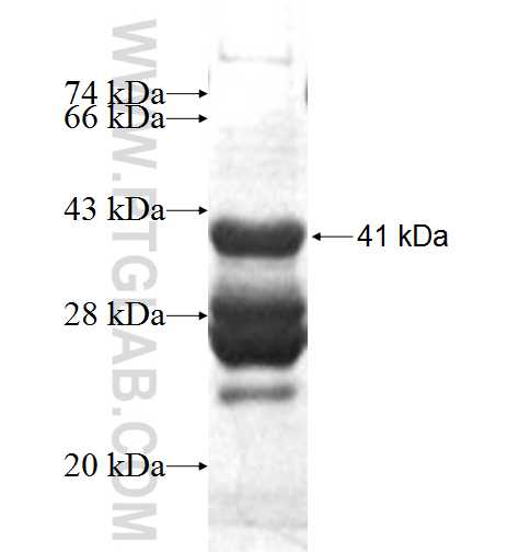 TRAPPC6B fusion protein Ag5438 SDS-PAGE
