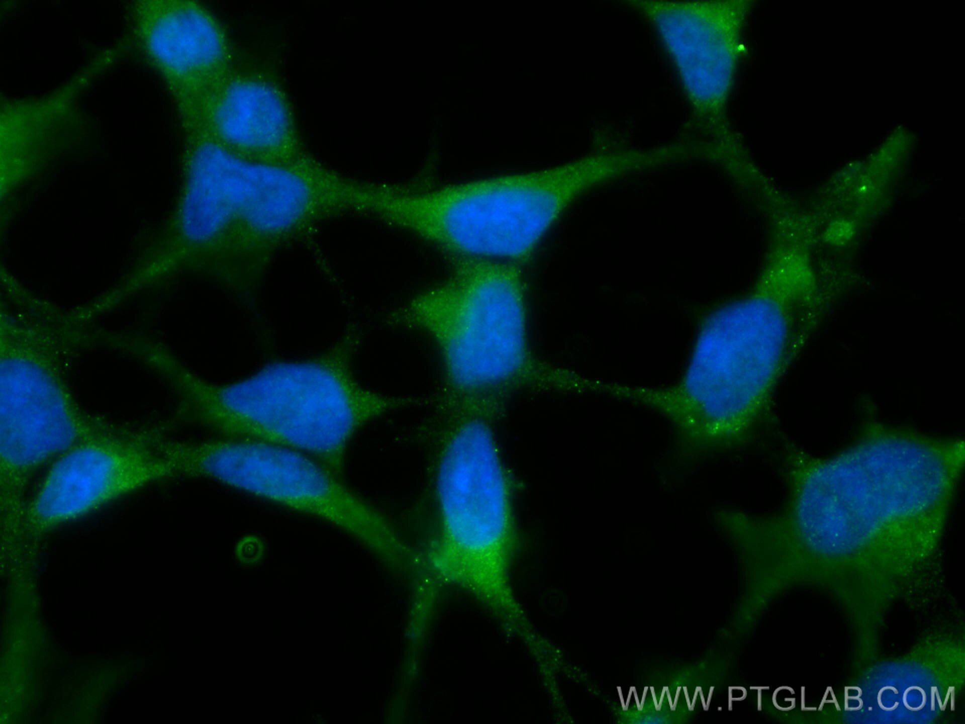 Immunofluorescence (IF) / fluorescent staining of HEK-293 cells using TRAPPC9, NIBP Polyclonal antibody (16014-1-AP)