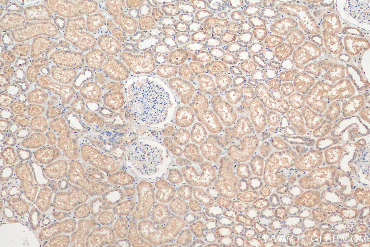 Immunohistochemistry (IHC) staining of human kidney tissue using TRAPPC9, NIBP Polyclonal antibody (16014-1-AP)