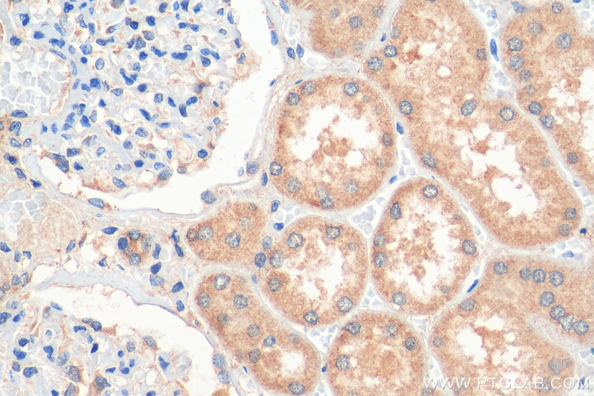 Immunohistochemistry (IHC) staining of human kidney tissue using TRAPPC9, NIBP Polyclonal antibody (16014-1-AP)