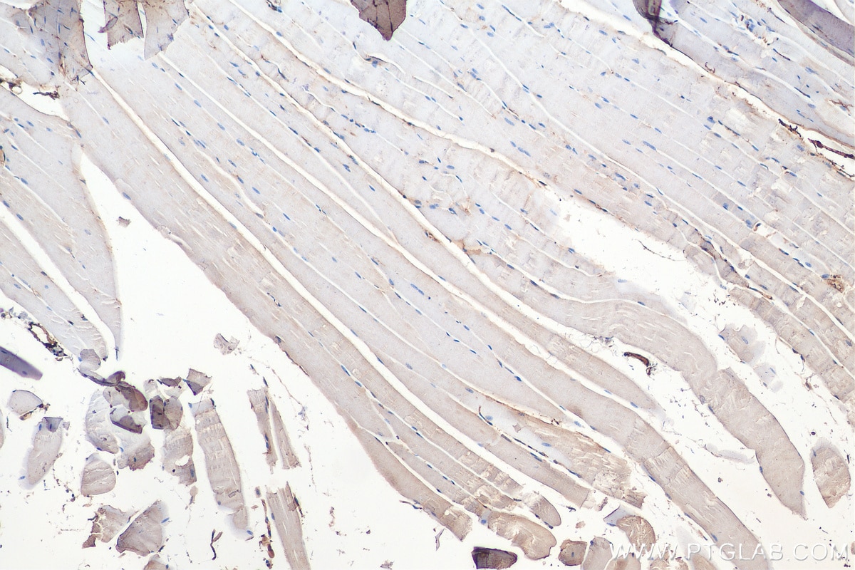 Immunohistochemistry (IHC) staining of mouse skeletal muscle tissue using TRAPPC9, NIBP Polyclonal antibody (16014-1-AP)