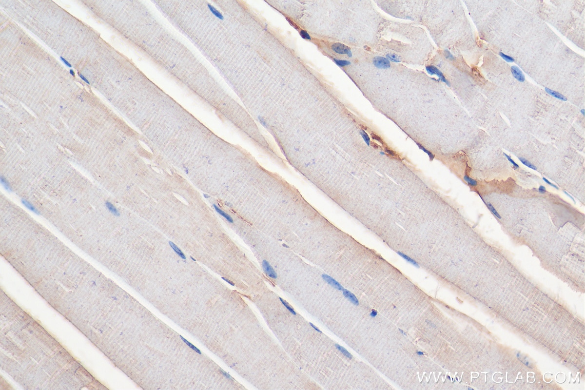 Immunohistochemistry (IHC) staining of mouse skeletal muscle tissue using TRAPPC9, NIBP Polyclonal antibody (16014-1-AP)