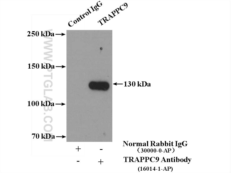 Immunoprecipitation (IP) experiment of mouse brain tissue using TRAPPC9, NIBP Polyclonal antibody (16014-1-AP)