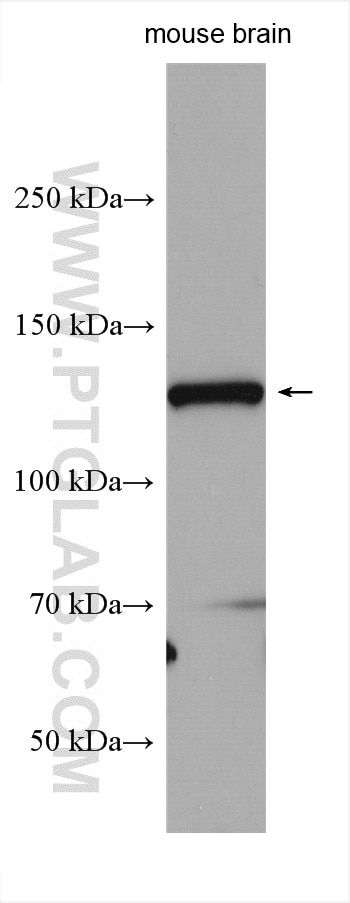 Western Blot (WB) analysis of mouse brain tissue using TRAPPC9, NIBP Polyclonal antibody (16014-1-AP)