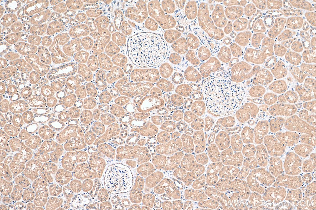 Immunohistochemistry (IHC) staining of human kidney tissue using TRAPPC9, NIBP Monoclonal antibody (66131-1-Ig)