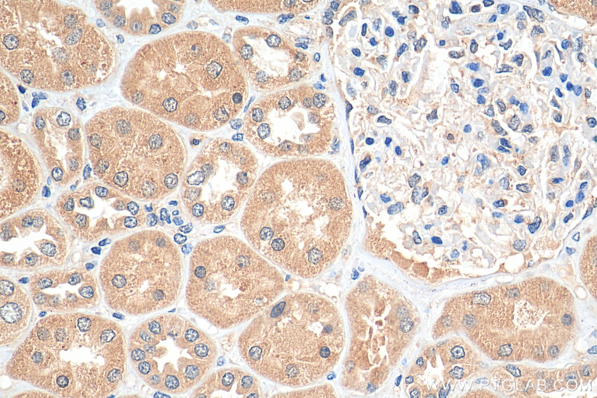 Immunohistochemistry (IHC) staining of human kidney tissue using TRAPPC9, NIBP Monoclonal antibody (66131-1-Ig)