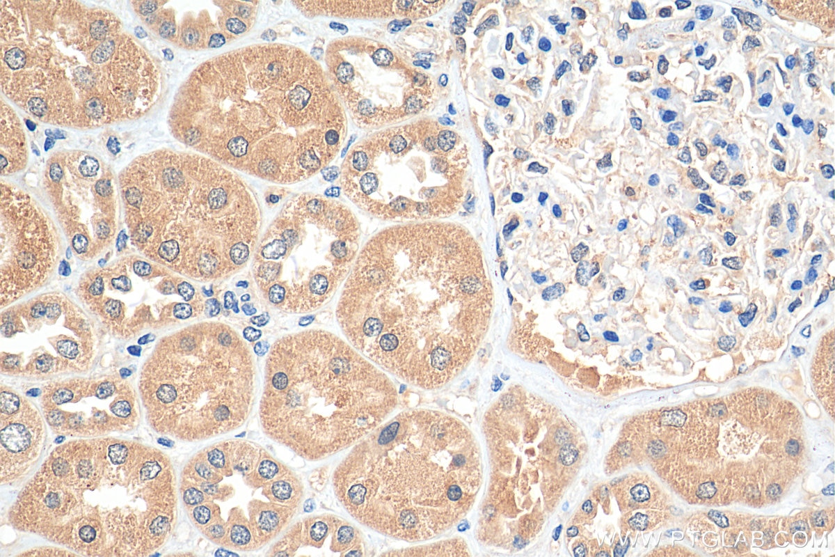 IHC staining of human kidney using 66131-1-Ig