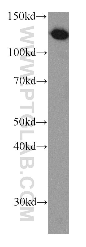 Western Blot (WB) analysis of human brain tissue using TRAPPC9, NIBP Monoclonal antibody (66131-1-Ig)