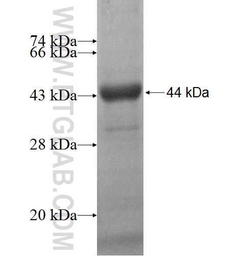 TRAPPC9,NIBP fusion protein Ag8949 SDS-PAGE