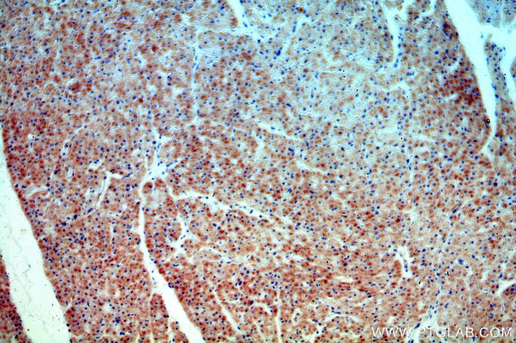 Immunohistochemistry (IHC) staining of human heart tissue using TRAPPC9/NIBP Polyclonal antibody (19549-1-AP)