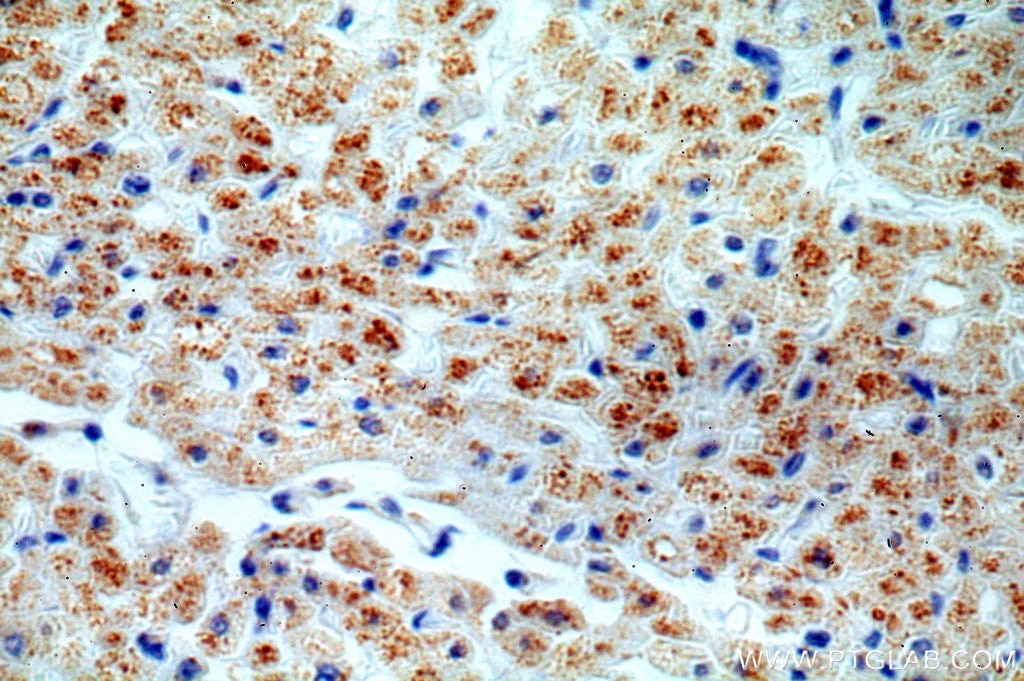 Immunohistochemistry (IHC) staining of human heart tissue using TRAPPC9/NIBP Polyclonal antibody (19549-1-AP)