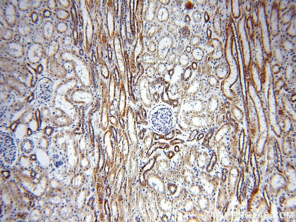 Immunohistochemistry (IHC) staining of human kidney tissue using TRAPPC9/NIBP Polyclonal antibody (19549-1-AP)
