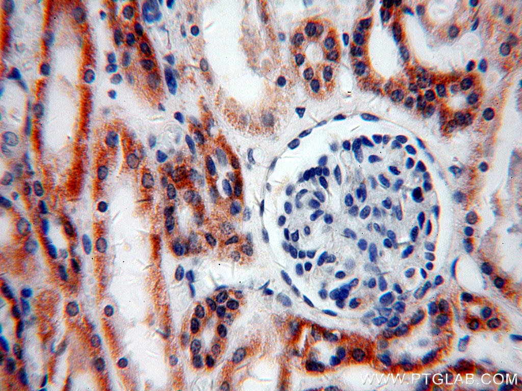 Immunohistochemistry (IHC) staining of human kidney tissue using TRAPPC9/NIBP Polyclonal antibody (19549-1-AP)