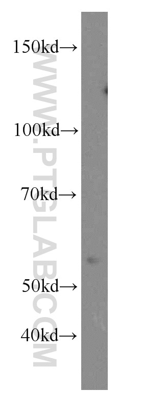 Western Blot (WB) analysis of human brain tissue using TRAPPC9/NIBP Polyclonal antibody (19549-1-AP)