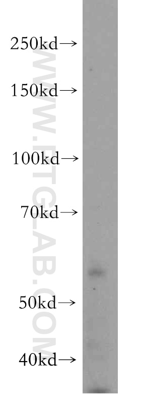Western Blot (WB) analysis of mouse kidney tissue using TRAPPC9/NIBP Polyclonal antibody (19549-1-AP)