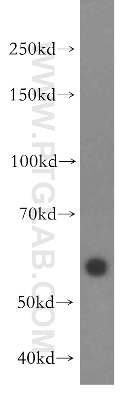 Western Blot (WB) analysis of SH-SY5Y cells using TRAPPC9/NIBP Polyclonal antibody (19549-1-AP)