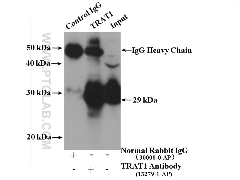 Immunoprecipitation (IP) experiment of Jurkat cells using TRAT1 Polyclonal antibody (13279-1-AP)
