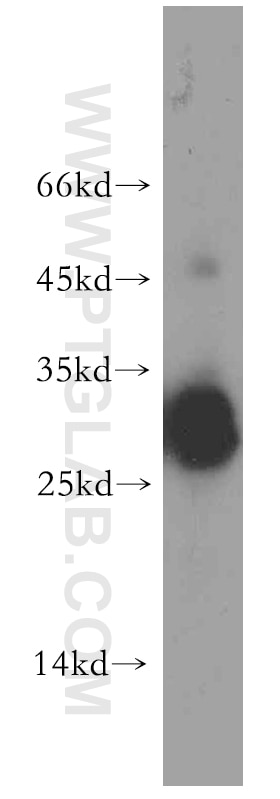 Western Blot (WB) analysis of Jurkat cells using TRAT1 Polyclonal antibody (13279-1-AP)