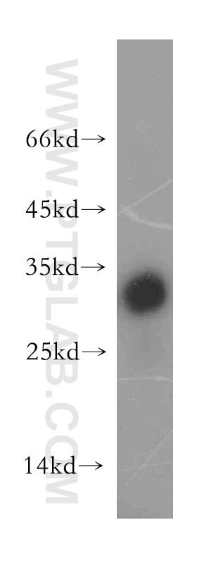 Western Blot (WB) analysis of mouse thymus tissue using TRAT1 Polyclonal antibody (13279-1-AP)