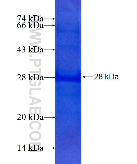 TRAT1 fusion protein Ag14404 SDS-PAGE TRAT1 fusion protein Ag14404 SDS-PAGE
