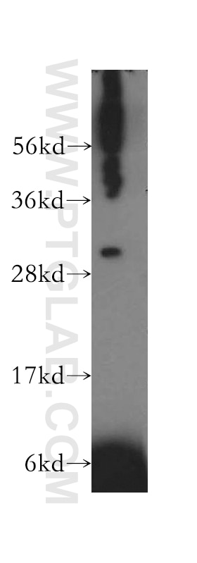 Western Blot (WB) analysis of K-562 cells using TRAV20 Polyclonal antibody (13132-1-AP)