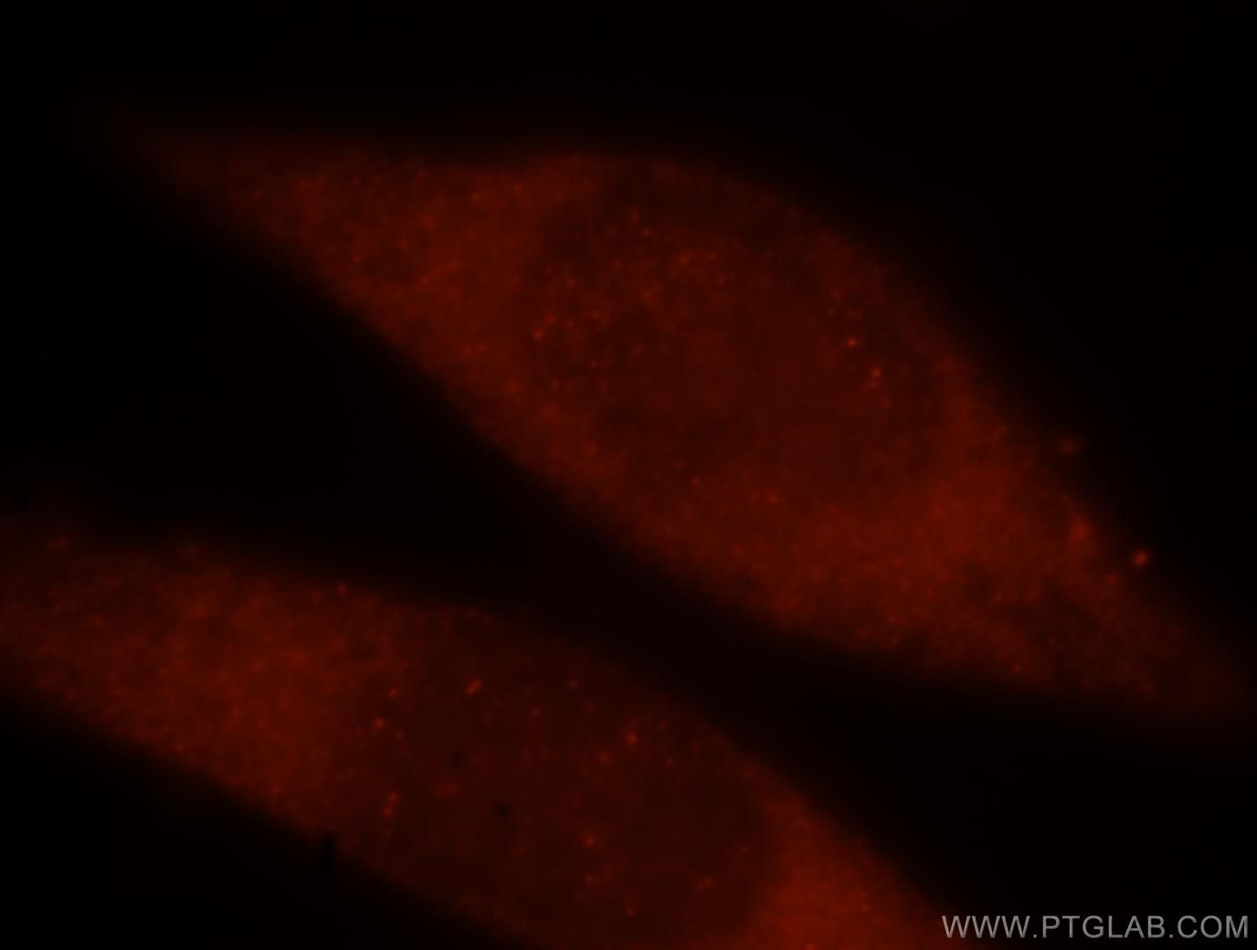 Immunofluorescence (IF) / fluorescent staining of HeLa cells using TRBP Polyclonal antibody (15753-1-AP)