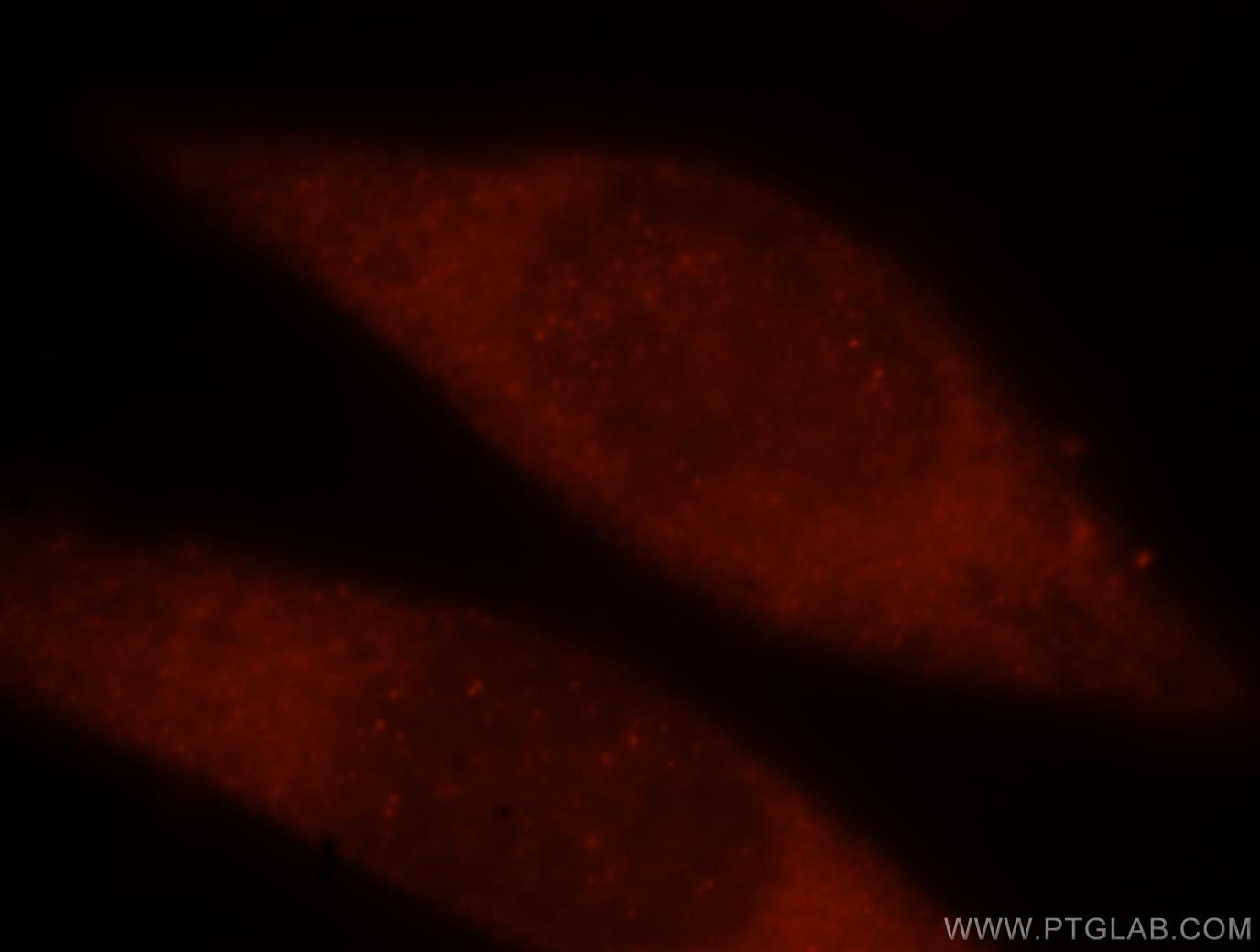 IF Staining of HeLa using 15753-1-AP