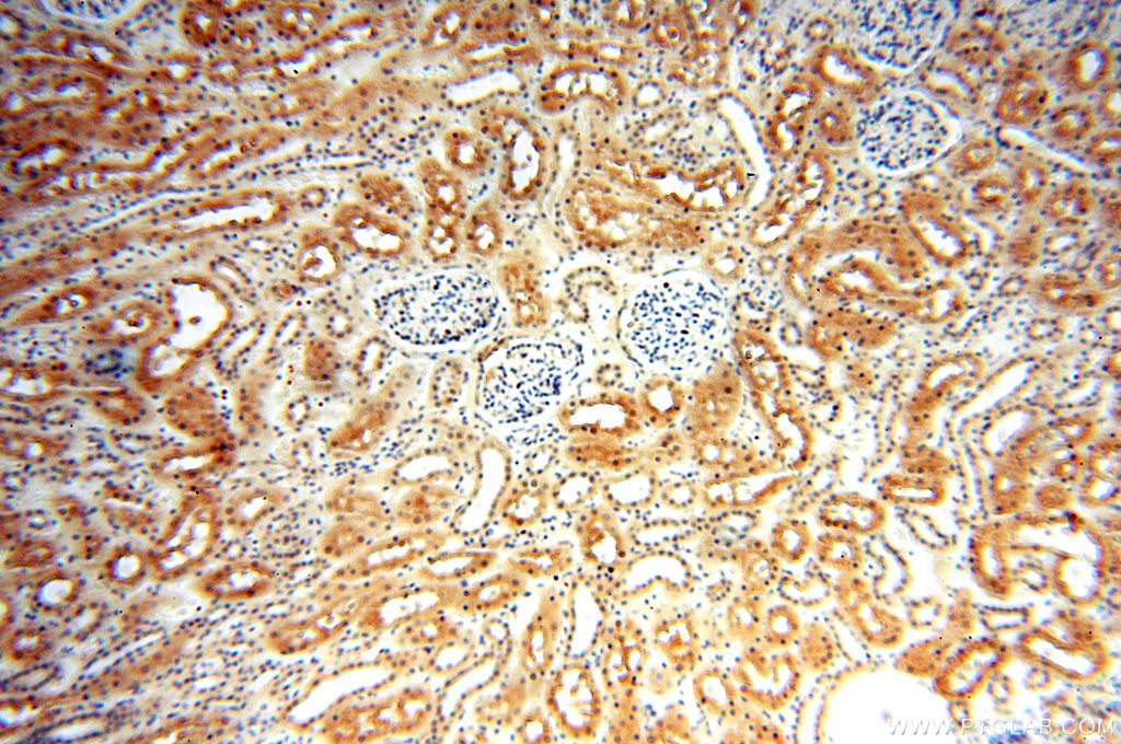 Immunohistochemistry (IHC) staining of human kidney tissue using TRBP Polyclonal antibody (15753-1-AP)