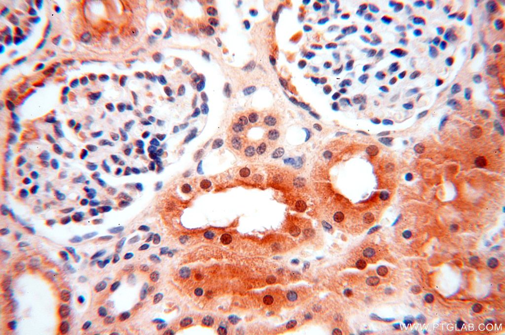 IHC staining of human kidney using 15753-1-AP