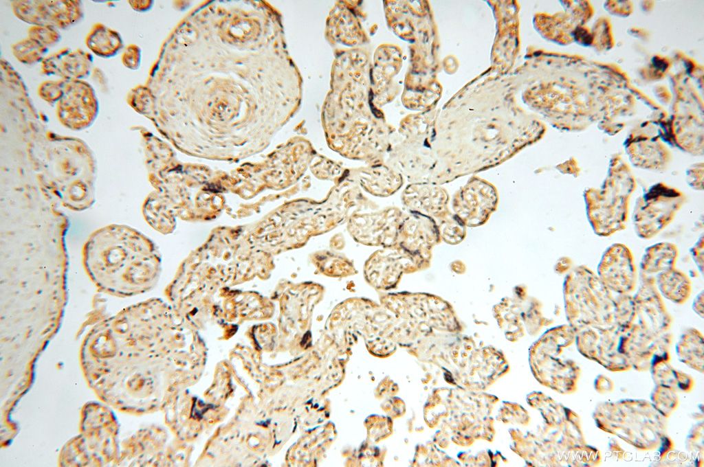 Immunohistochemistry (IHC) staining of human placenta tissue using TRBP Polyclonal antibody (15753-1-AP)