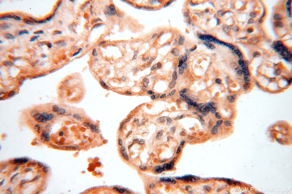 Immunohistochemistry (IHC) staining of human placenta tissue using TRBP Polyclonal antibody (15753-1-AP)