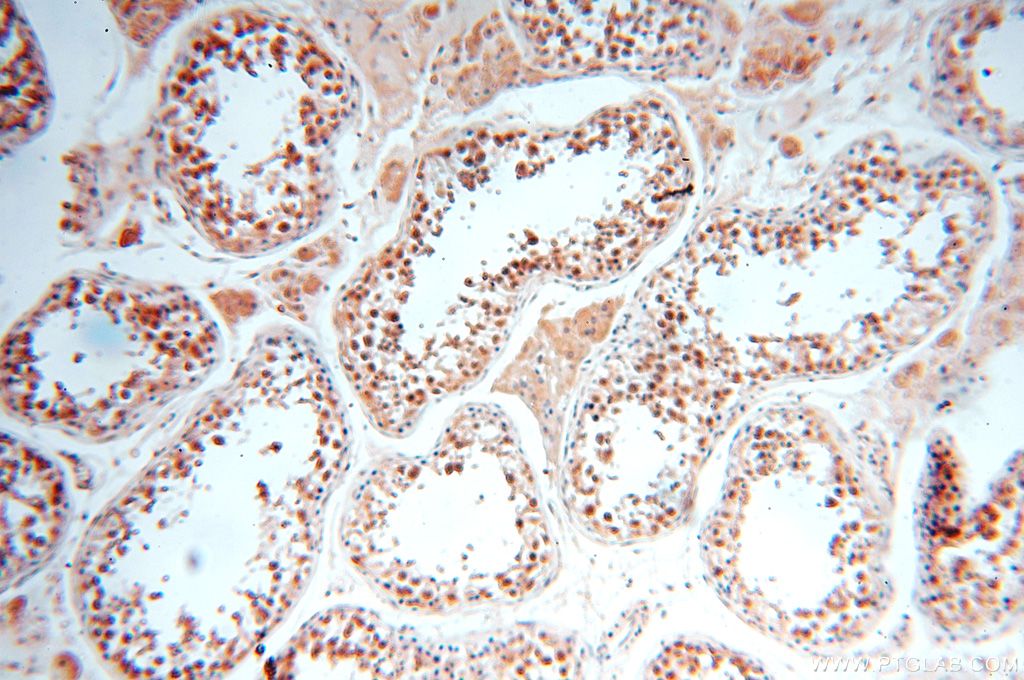 Immunohistochemistry (IHC) staining of human testis tissue using TRBP Polyclonal antibody (15753-1-AP)