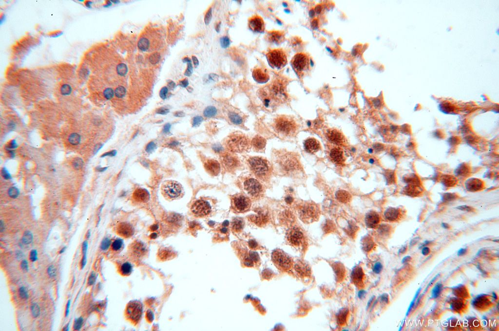 Immunohistochemistry (IHC) staining of human testis tissue using TRBP Polyclonal antibody (15753-1-AP)