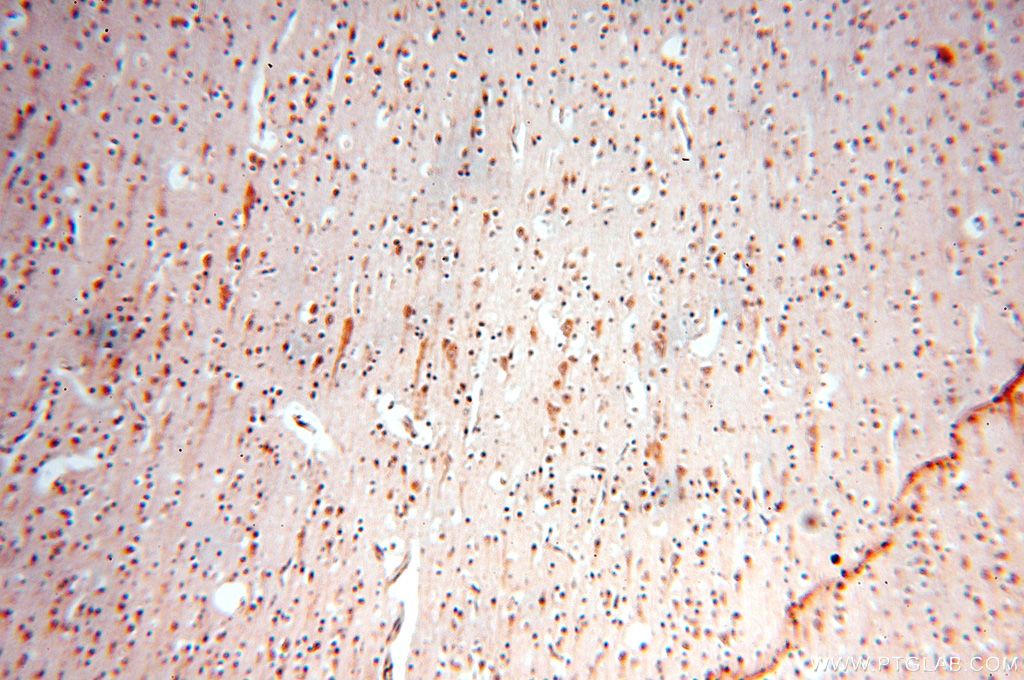 Immunohistochemistry (IHC) staining of human brain tissue using TRBP Polyclonal antibody (15753-1-AP)