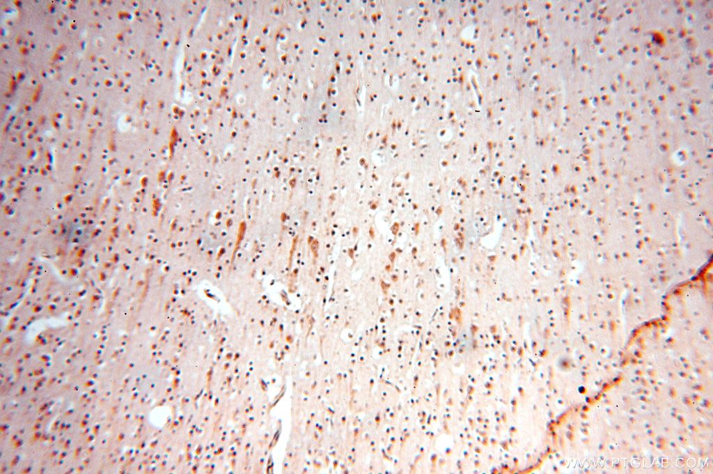 IHC staining of human brain using 15753-1-AP