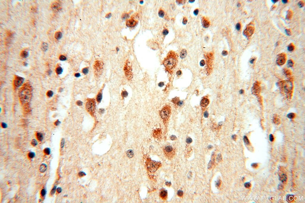 Immunohistochemistry (IHC) staining of human brain tissue using TRBP Polyclonal antibody (15753-1-AP)